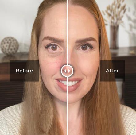 Before and after application of under-eye bag removal cream showcasing visible results in under-eye area