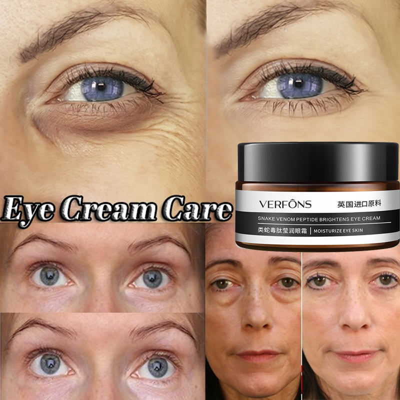 Before and after images showcasing the effects of firming eye cream for reducing wrinkles and brightening the eye area